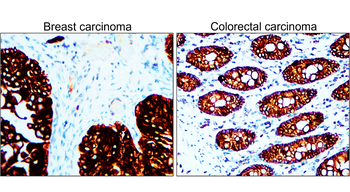 Pan-Cytokeratin, Pan-CK Antibody