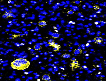 EpCAM/CD326 (Extracellular domain) Antibody