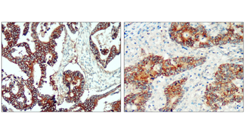 EpCAM/CD326 (Extracellular domain) Antibody