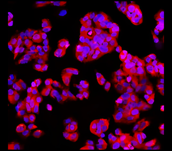 EpCAM/CD326 (Intracellular domain) Antibody