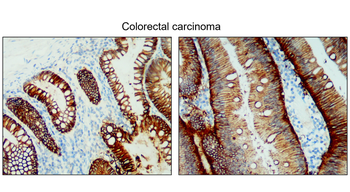 EpCAM/CD326 (Intracellular domain) Antibody
