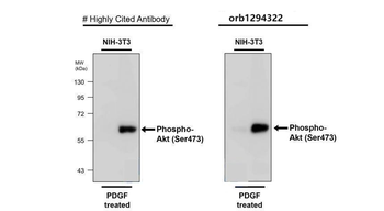Phospho-AKT (Ser473) Antibody