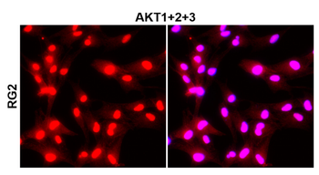 Akt1+2+3 Rabbit Polyclonal Antibody