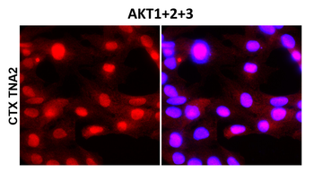 Akt1+2+3 Rabbit Polyclonal Antibody