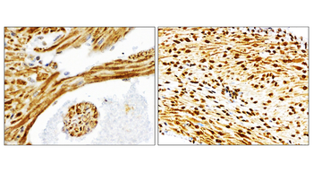 NFE2L2/NRF2 Antibody