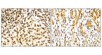 NFE2L2/NRF2 Antibody