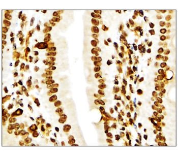 NFE2L2/NRF2 Antibody