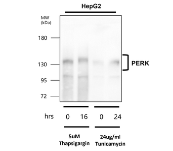 PERK Rabbit Polyclonal Antibody