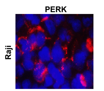 PERK Rabbit Polyclonal Antibody