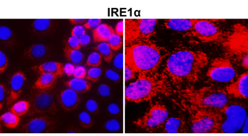 IRE1α Rabbit Polyclonal Antibody