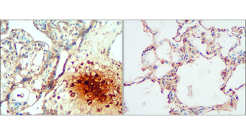 IL-1 beta Rabbit Polyclonal Antibody