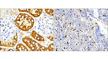 IL-1 beta Rabbit Polyclonal Antibody