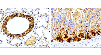IL-1 beta Rabbit Polyclonal Antibody