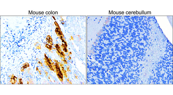 COX2 Rabbit Polyclonal Antibody
