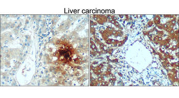 TNF alpha Rabbit Polyclonal Antibody