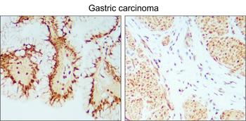 cleaved PARP Asp214 Rabbit Polyclonal Antibody