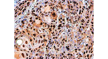 cleaved PARP Asp214 Rabbit Polyclonal Antibody