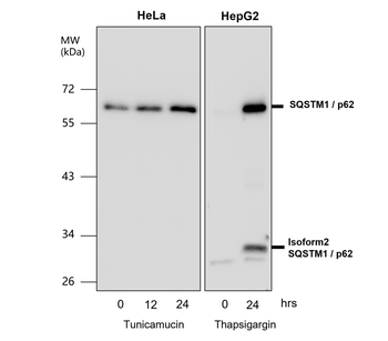 SQSTM1/P62 Antibody