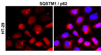 SQSTM1/P62 Antibody