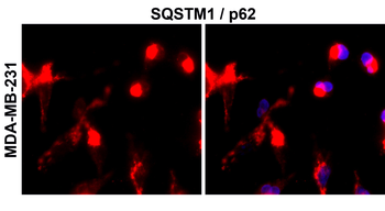 SQSTM1/P62 Antibody