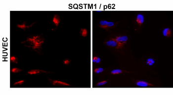 SQSTM1/P62 Antibody