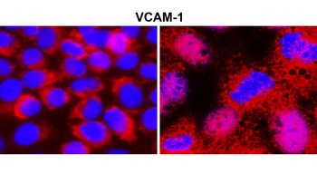 VCAM-1 Rabbit Polyclonal Antibody