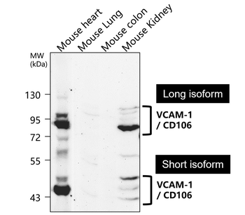 VCAM-1 Rabbit Polyclonal Antibody
