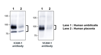 VCAM-1 Rabbit Polyclonal Antibody