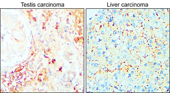 MMP14 Rabbit Polyclonal Antibody