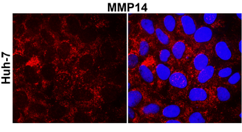 MMP14 Rabbit Polyclonal Antibody