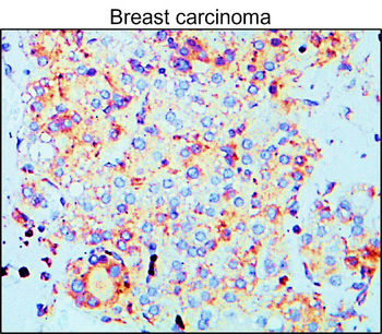 MMP9 Rabbit Polyclonal Antibody