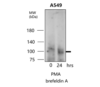 MMP9 Rabbit Polyclonal Antibody