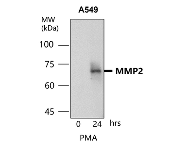 MMP2 Antibody