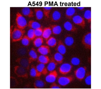 MMP1 Rabbit Polyclonal Antibody