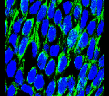 OCLN Rabbit Polyclonal Antibody