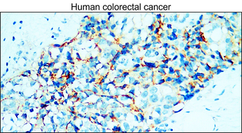 E-cadherin (Intracellular) Antibody