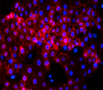 E-cadherin (Intracellular) Antibody