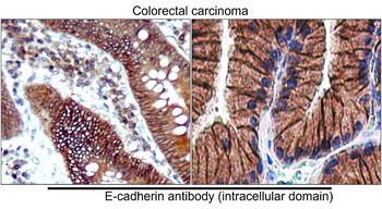E-cadherin (Intracellular) Antibody