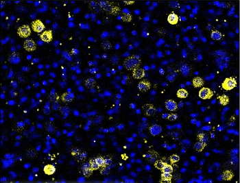 Beta-catenin Antibody