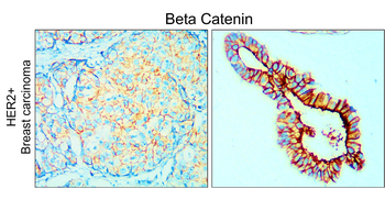 Beta-catenin Antibody