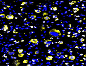 α-Smooth Muscle Actin Antibody