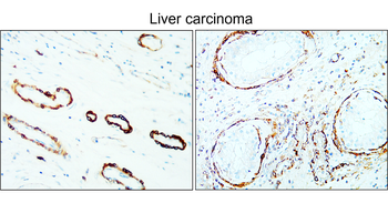 α-Smooth Muscle Actin Antibody