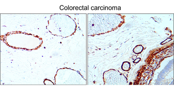α-Smooth Muscle Actin Antibody