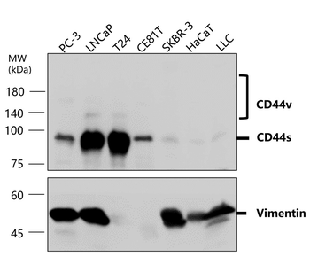 Vimentin Antibody