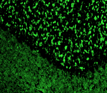 Alpha-synuclein Rabbit Polyclonal Antibody