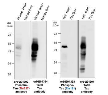 Phospho-Tau (Thr217) Rabbit Polyclonal Antibody