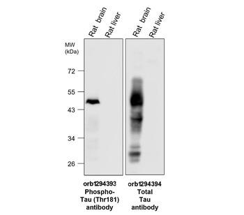 Phospho-Tau (Thr181) Antibody