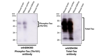 Phospho-Tau (Thr181) Antibody