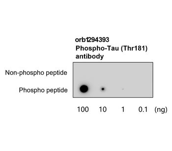 Phospho-Tau (Thr181) Antibody
