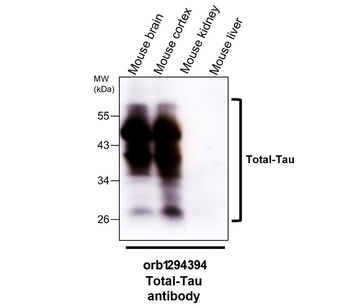 Tau Rabbit Polyclonal Antibody